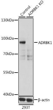 [KO Validated] GRK2 Rabbit Polyclonal Antibody (CAB1662)