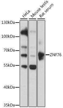 ZNF76 Rabbit Polyclonal Antibody (CAB16627)