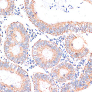 eIF4EBP1 Rabbit Polyclonal Antibody (CAB16667)