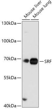 SRF Rabbit Polyclonal Antibody (CAB16718)