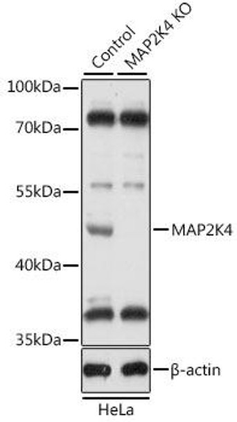 Anti-MAP2K4 Antibody (CAB14781)[KO Validated]