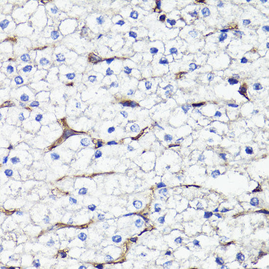 CD44 Rabbit Polyclonal Antibody (CAB16807)