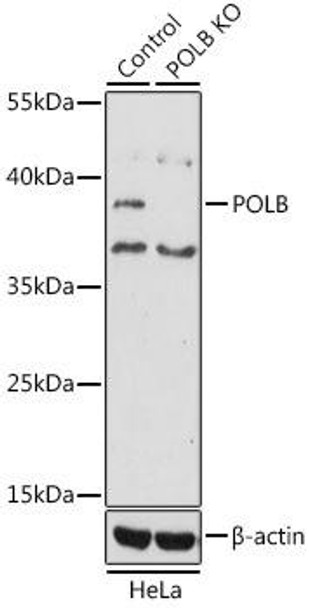 [KO Validated] DNA Polymerase beta Rabbit Polyclonal Antibody (CAB1681)