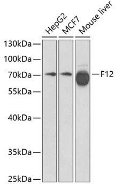 F12 Rabbit Polyclonal Antibody (CAB1691)