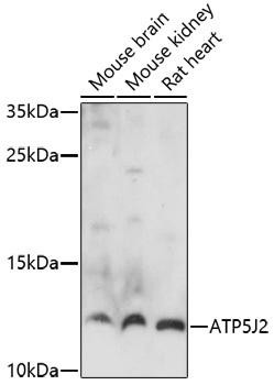 ATP5J2 Rabbit Polyclonal Antibody (CAB17055)