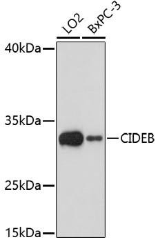 CIDEB Rabbit Polyclonal Antibody (CAB17140)