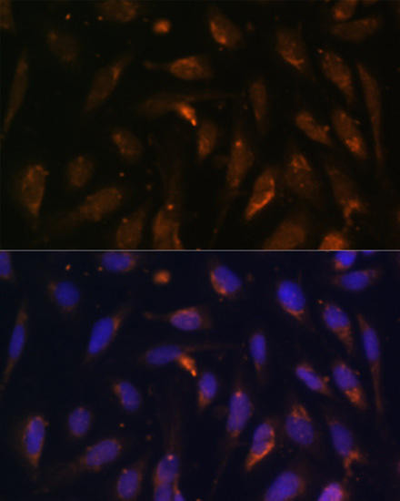 RAB8A Rabbit Polyclonal Antibody (CAB17369)