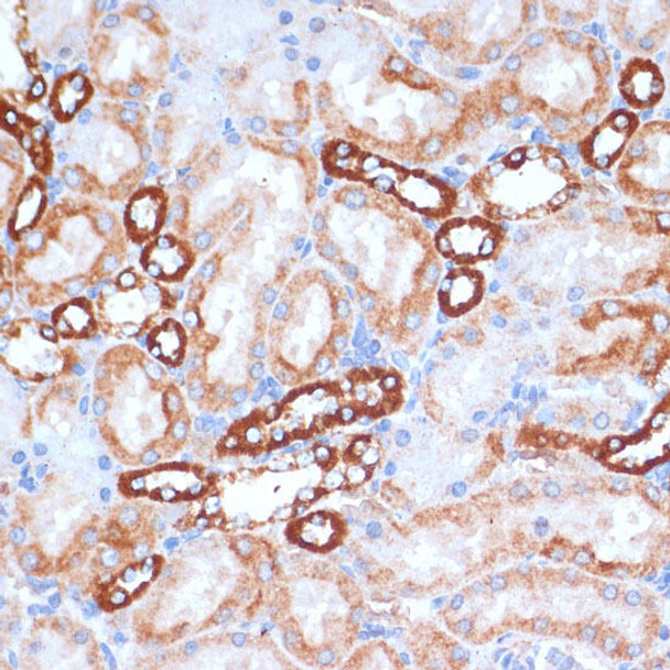 MTCO1 Rabbit Polyclonal Antibody (CAB17889)