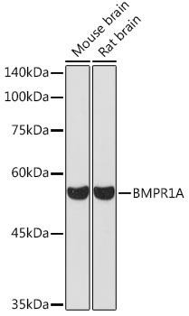 BMPR1A Rabbit Polyclonal Antibody (CAB1816)