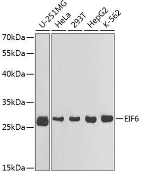 EIF6 Rabbit Polyclonal Antibody (CAB1818)