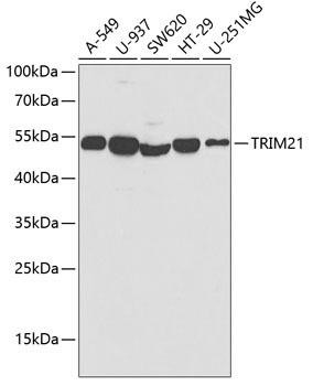 TRIM21 Rabbit Polyclonal Antibody (CAB1957)