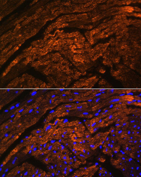 Anti-TTN Antibody (CAB16730)