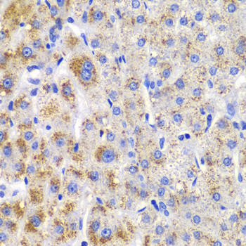 CBLB Rabbit Polyclonal Antibody (CAB2014)
