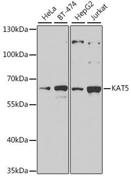 Anti-KAT5 Antibody (CAB1678)