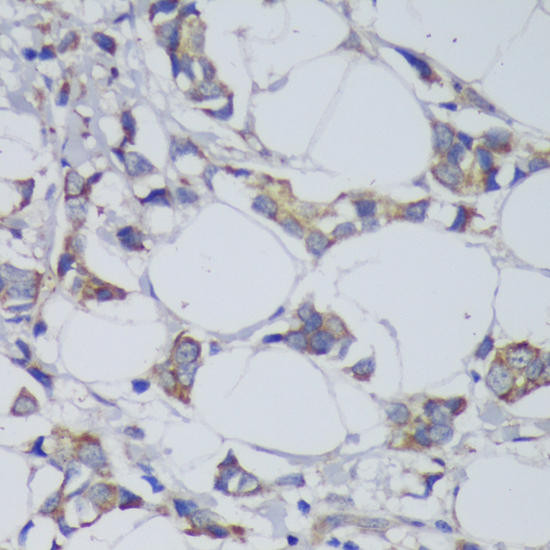 GSK3β Rabbit Polyclonal Antibody (CAB2081)