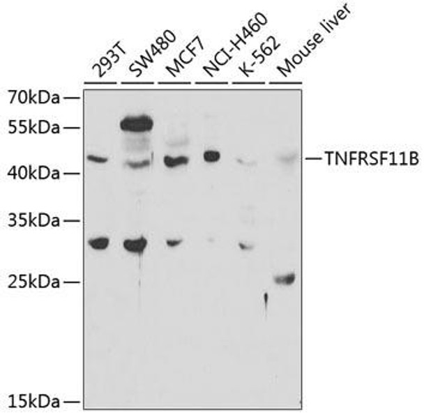 Anti-TNFRSF11B Antibody (CAB2100)