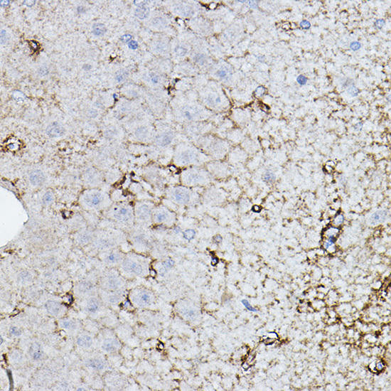 CHAT Rabbit Polyclonal Antibody (CAB2495)