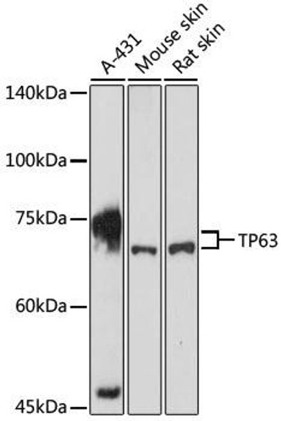 Anti-TP63 Antibody (CAB2137)