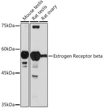 Estrogen Receptor beta Rabbit Polyclonal Antibody (CAB2546)