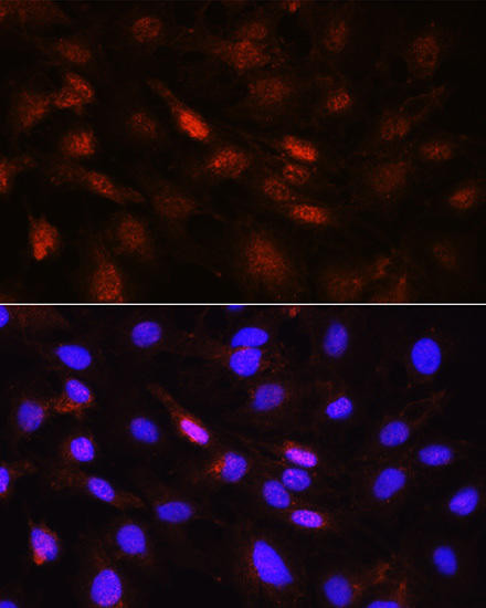 PLK1 Rabbit Polyclonal Antibody (CAB2548)
