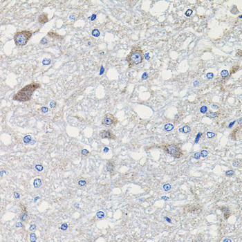 CDH23 Rabbit Polyclonal Antibody (CAB2785)