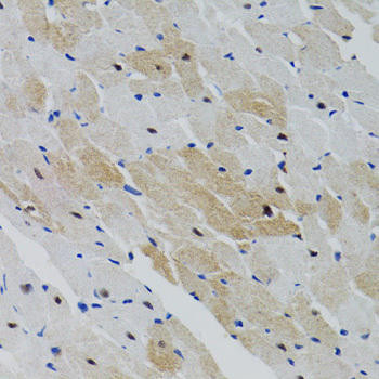 SHP2 Rabbit Polyclonal Antibody (CAB2793)
