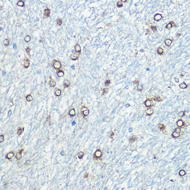 Anti-CD63 Antibody (CAB5271)