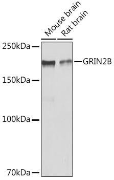 GRIN2B Rabbit Polyclonal Antibody (CAB3056)