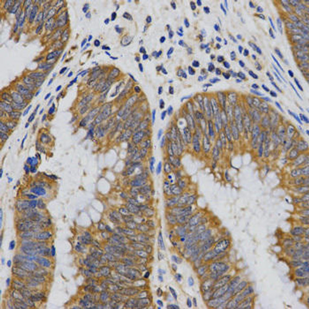 PIBF1 Rabbit Polyclonal Antibody (CAB3072)