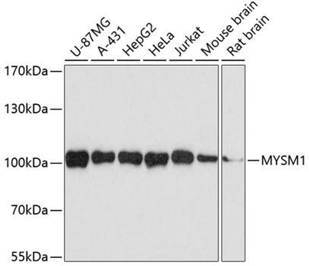 MYSM1 Rabbit Polyclonal Antibody (CAB3102)