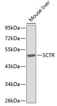 SCTR Rabbit Polyclonal Antibody (CAB3125)
