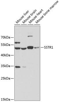 SSTR1 Rabbit Polyclonal Antibody (CAB3134)
