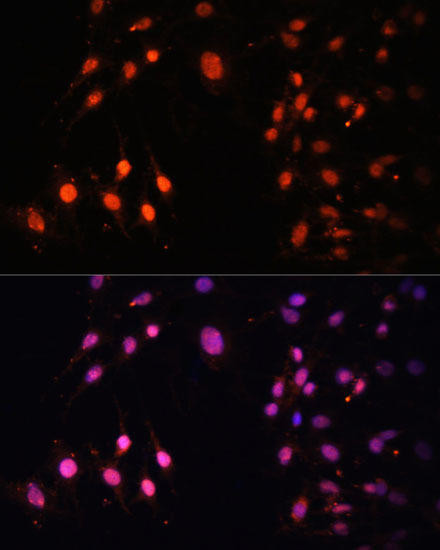 SETD2 Rabbit Polyclonal Antibody (CAB3194)