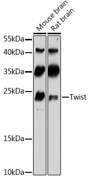 Twist Rabbit Polyclonal Antibody (CAB3237)
