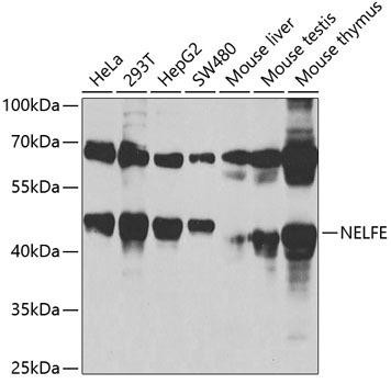 NELFE Rabbit Polyclonal Antibody (CAB3249)