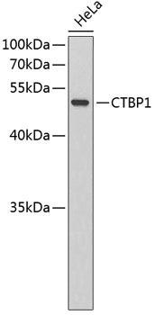CtBP1 Rabbit Polyclonal Antibody (CAB3257)