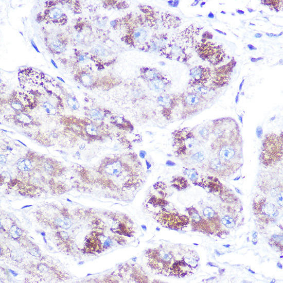 NR3C2 Rabbit Polyclonal Antibody (CAB3308)