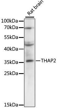 THAP2 Rabbit Polyclonal Antibody (CAB3518)