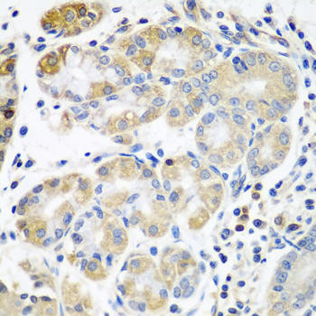 PLS3 Rabbit Polyclonal Antibody (CAB3627)