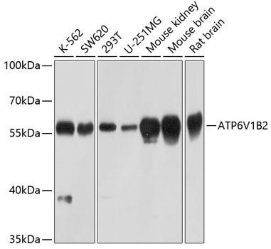 ATP6V1B2 Rabbit Polyclonal Antibody (CAB3754)