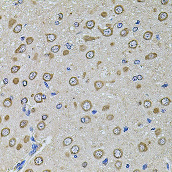 EIF4A2 Rabbit Polyclonal Antibody (CAB3849)