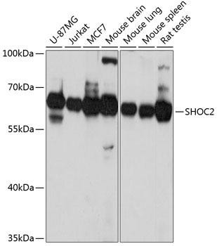 SHOC2 Rabbit Polyclonal Antibody (CAB4199)