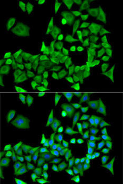 Anti-PPP2R1A Antibody (CAB5799)