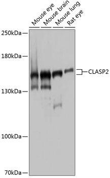 CLASP2 Rabbit Polyclonal Antibody (CAB4528)