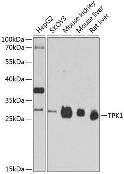 TPK1 Rabbit Polyclonal Antibody (CAB4634)