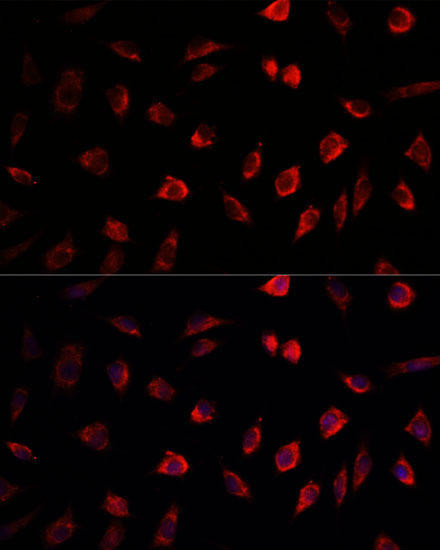 NEDD1 Rabbit Polyclonal Antibody (CAB5128)