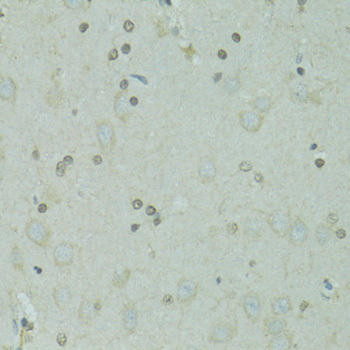 GTF2H2C Rabbit Polyclonal Antibody (CAB5239)