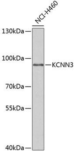 Anti-KCNN3 Antibody (CAB6125)