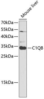 C1QB Rabbit Polyclonal Antibody (CAB5339)