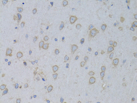 GARS Rabbit Polyclonal Antibody (CAB5435)